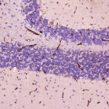 Anti-C Reactive Protein/Crp Antibody