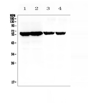 Cytochrome P450 17A1/Cyp17a1 Antibody