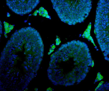 Anti-Cytochrome P450 17A1/Cyp17a1 Antibody
