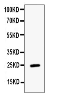 Anti-ESM1 Antibody