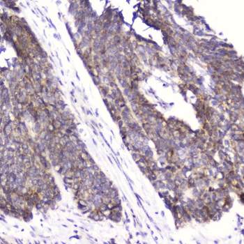 Anti-Cardiac FABP/FABP3 Antibody