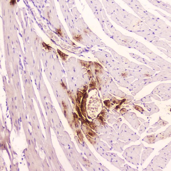 Anti-ANP/Nppa Antibody