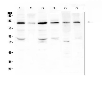 PDGF Receptor beta/PDGFRB Antibody