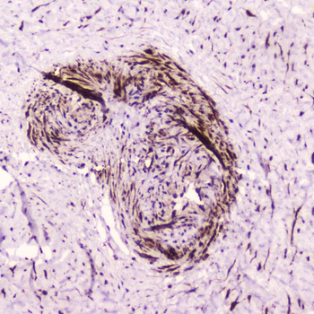 Anti-PDGF Receptor beta/PDGFRB Antibody