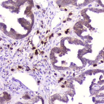 Anti-Ribonuclease 3/RNASE3 Antibody
