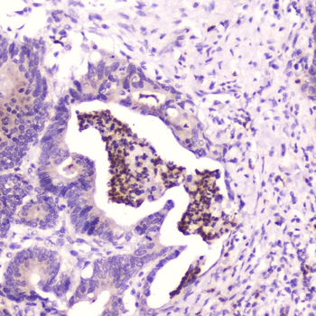 Anti-SPARCL1 Antibody