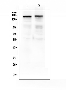 Anti-Thrombospondin 2/THBS2 Antibody