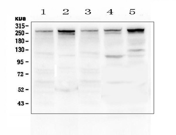 Talin 1/TLN1 Antibody