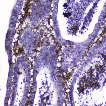 Anti-Talin 1/TLN1 Antibody