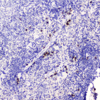 Anti-HE4/WFDC2 Antibody