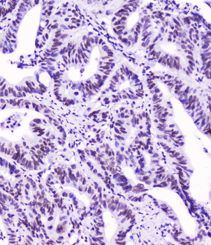 SMC3 Antibody (monoclonal, 4C12)