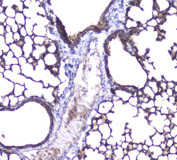 Anti-Aquaporin 5/AQP5 Antibody