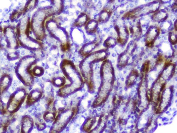 Anti-Amphiregulin/Areg Antibody