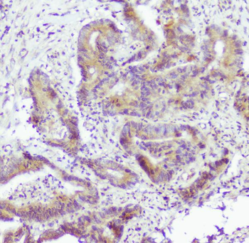 Anti-Caspase-2/CASP2 Antibody