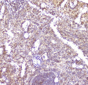 Anti-CCL6 Antibody