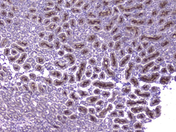 Anti-CCL8 Antibody