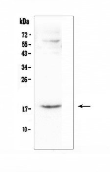 Anti-CCL16 Antibody