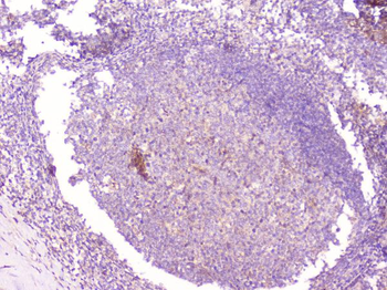 Anti-CD1b Antibody