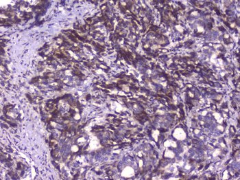 Anti-CIC Antibody