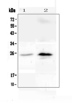 C Reactive Protein/CRP Antibody