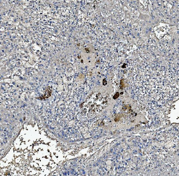 Anti-C Reactive Protein/CRP Antibody