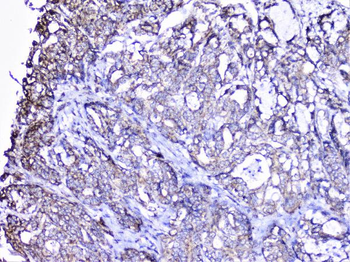 Anti-Cortactin/CTTN Antibody