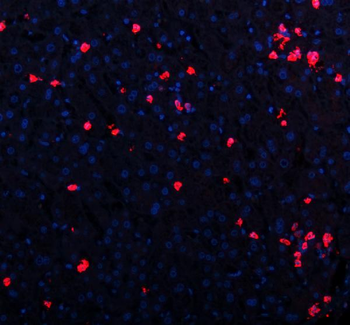 Anti-CXCL12 Antibody