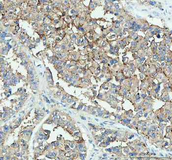 Anti-DDT Antibody