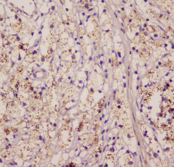 Anti-EML4 Antibody