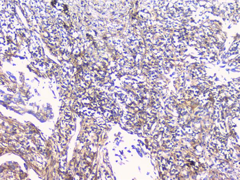 Anti-FCGR2A Antibody