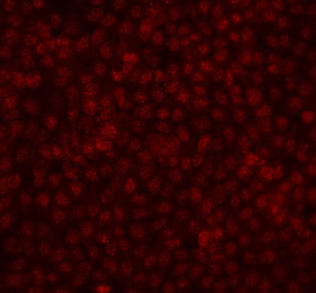 Anti-FGF2 Antibody