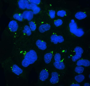 Anti-GOLPH3 Antibody