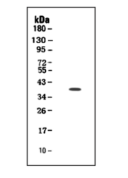 Anti-TIM 1/HAVCR1 Antibody