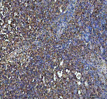 Anti-Interferon gamma/IFNG Antibody