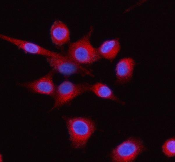 Anti-LMAN1 Antibody