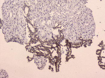 Anti-LRIG1 Antibody