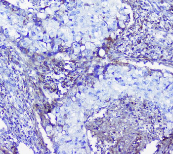 Anti-Lumican Antibody