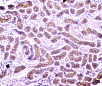 Anti-PON1 Antibody