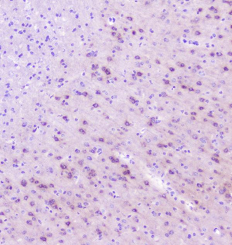 Anti-RASAL1/RASAL1 Antibody