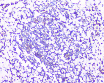 Anti-RPS3 Antibody