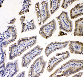 Anti-TNF Receptor I/TNFRSF1A Antibody