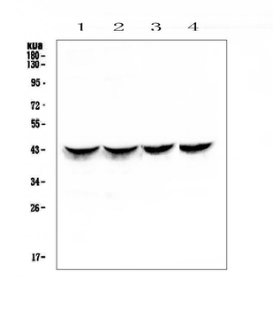 Anti-Cardiac Troponin T/TNNT2 Antibody