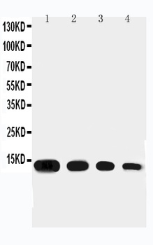 Anti-Eotaxin/CCL11 Antibody