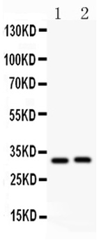 Anti-IL1 beta/IL1B Antibody