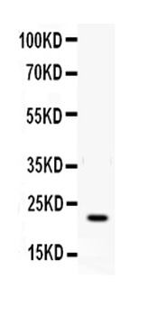 Anti-IFN gamma Antibody