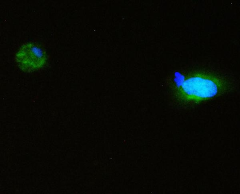 Anti-SQSTM1/p62 Antibody