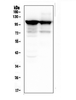 ACTN3 Antibody (monoclonal, 9B5)