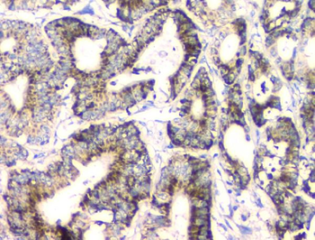 Anti-FH Antibody (monoclonal, 9D8)