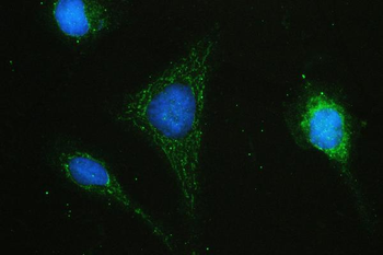 Anti-Hyaluronan synthase 1/HAS1 Antibody