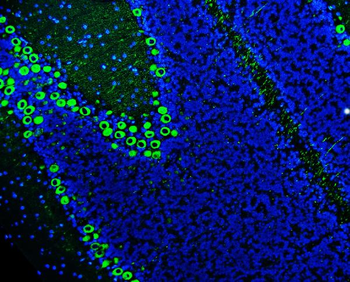 Anti-PKC gamma/PRKCG Antibody